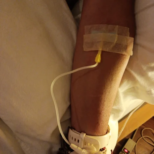 Primer plano de un brazo con una vía intravenosa insertada, asegurada con cinta médica, mientras una persona con guantes ajusta el conector del tubo para administrar sueroterapia doctora metabolismo